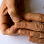 How Paronychia Treatments Improve Long-Term Nail Health